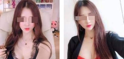 沈陽杏林整形美容醫(yī)院崔昌墉醫(yī)生做假體隆胸技術怎么樣？附案例