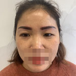 手術(shù)前的照片