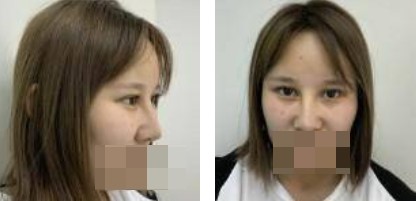 113RM0S-0.jpg 113RM0S-0.jpg