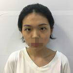 做完雙眼皮手術(shù)，不化妝也自帶美顏效果！