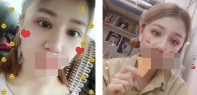 做了全切雙眼皮不僅外表變美了，內(nèi)心也更加自信了