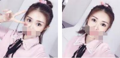 沒(méi)有了眼袋困擾，身體和心態(tài)都年輕了十歲