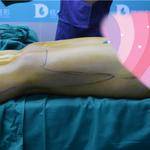 做完雙腿吸脂手術(shù)，穿上我的長(zhǎng)筒靴，盡顯女性魅力！