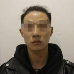 術前照片 術前照片