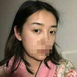 做完雙眼皮手術(shù)眼睛更加迷人了，眼睛自己會撩小哥哥