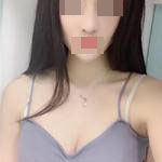 自體脂肪隆胸+隆鼻后形象瞬間提升，對生活更加自信了