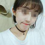 做完埋線提升后，松弛的臉蛋拜拜了