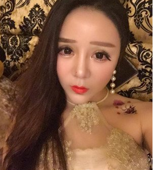 深圳南西子黃藝做自體脂肪隆胸案例效果對(duì)比圖 深圳南西子黃藝做自體脂肪隆胸案例效果對(duì)比圖