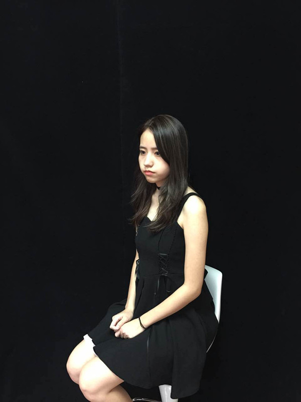 佛山曙光金子醫(yī)學整形醫(yī)生劉洲尉做埋線隆鼻技術(shù)怎么樣？附案例