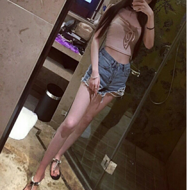 合肥壹加壹整形醫(yī)生周福田做腰腹吸脂技術(shù)怎么樣？附腰腹吸脂案例