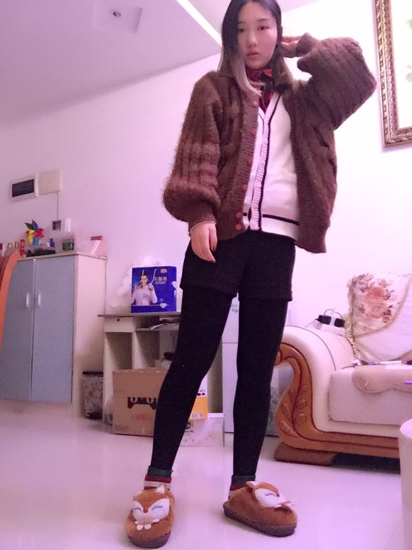 成都美立方整形醫(yī)院黃華醫(yī)生做大腿吸脂怎么樣？附大腿吸脂案例