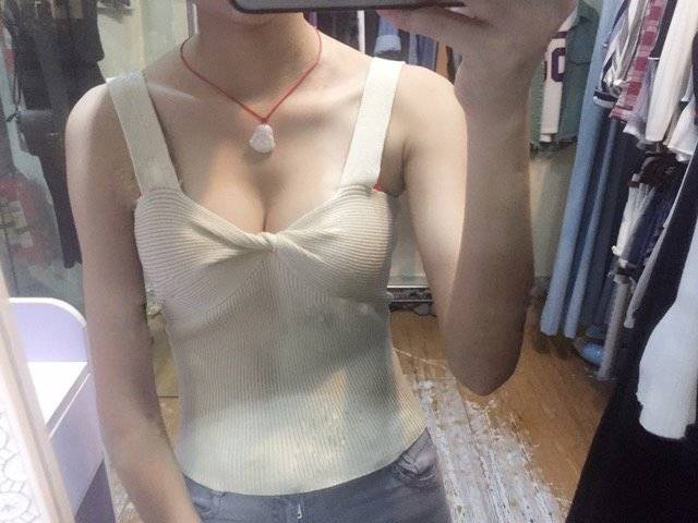 嘉興華山醫(yī)療美容醫(yī)院做假體隆胸怎么樣？嘉興華山陳榮忠假體隆胸案例