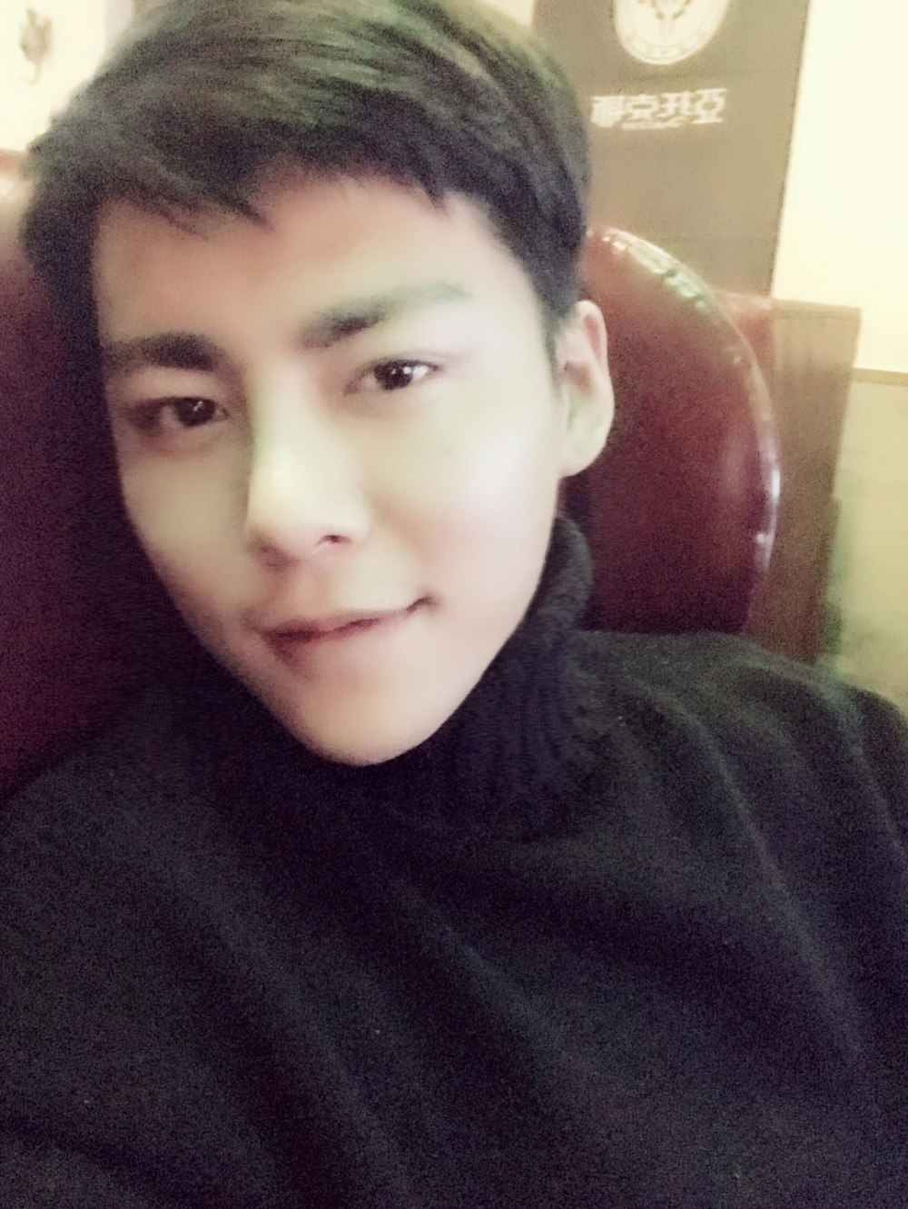 濟(jì)寧名美醫(yī)療整形醫(yī)生李唯少假體隆鼻+耳軟骨墊鼻尖真實(shí)案例效果對比圖