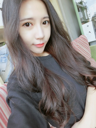 濟南安美醫(yī)療整形醫(yī)生李思思下頜角整形案例 濟南安美醫(yī)療整形醫(yī)生李思思下頜角整形案例