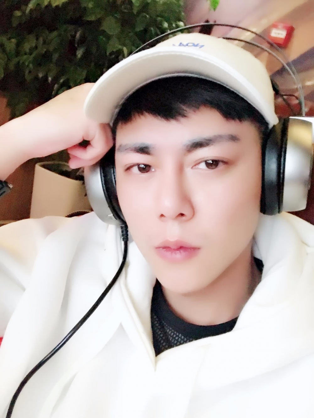 濟(jì)寧名美醫(yī)療整形醫(yī)生李唯少假體隆鼻+耳軟骨墊鼻尖真實(shí)案例效果對比圖