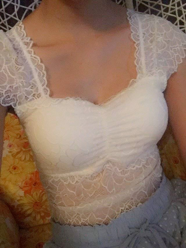 嘉興華山陳榮忠假體隆胸案例 嘉興華山陳榮忠假體隆胸案例