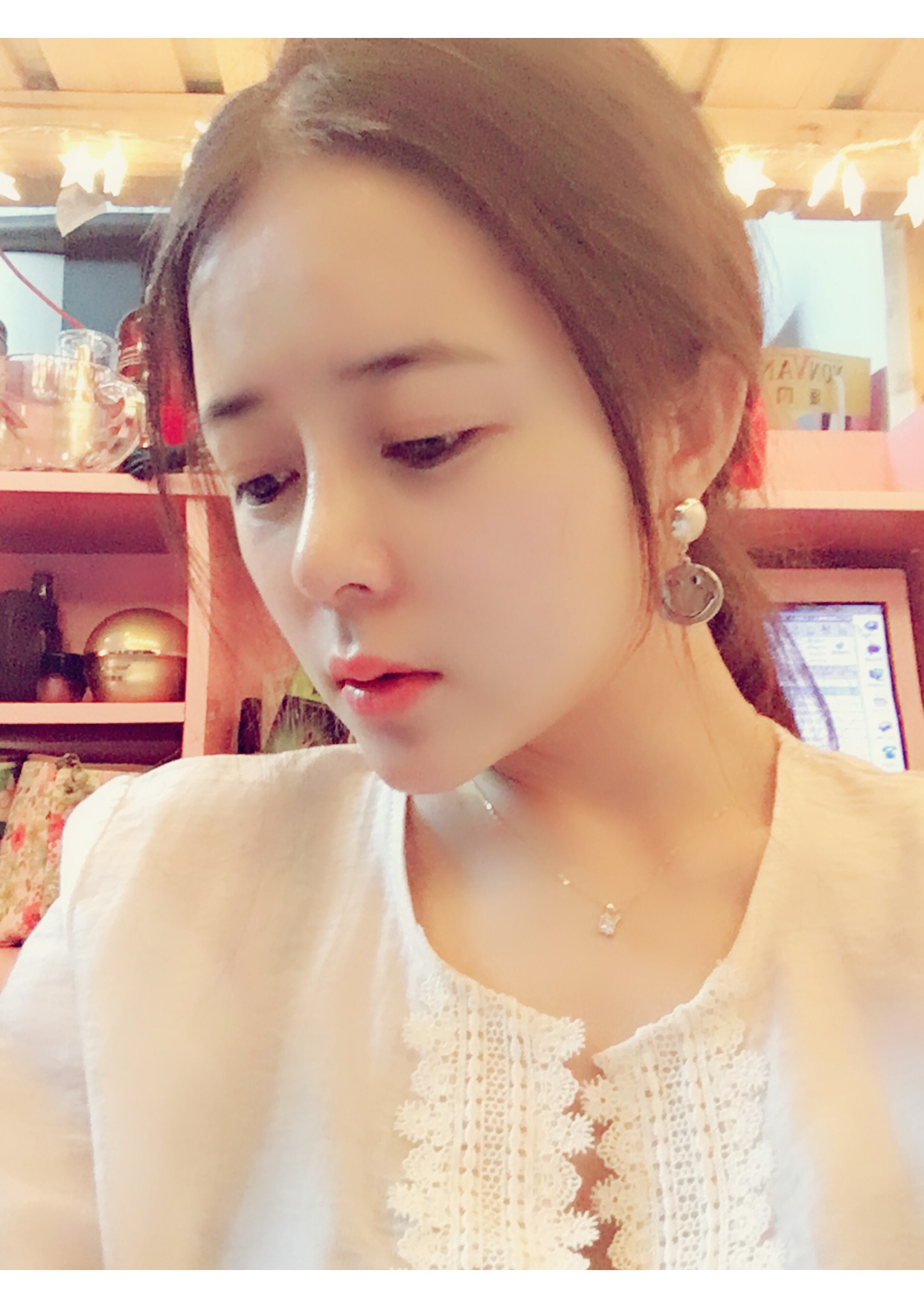 北京世濟周志強醫(yī)生鼻綜合案例