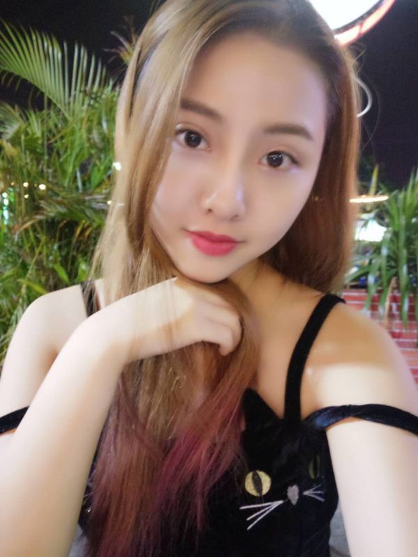 整形醫(yī)生徐長(zhǎng)亮做切開雙眼皮案例效果對(duì)比圖