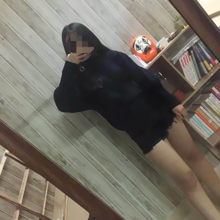 廣州軍頤醫(yī)院整形美容中心石建薇醫(yī)生腰腹吸脂真實案例對比圖 廣州軍頤醫(yī)院整形美容中心石建薇醫(yī)生腰腹吸脂真實案例對比圖