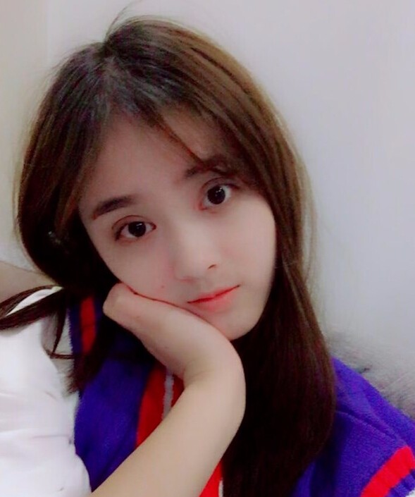 福州愛美爾整形黃林勝雙眼皮案例效果對比圖