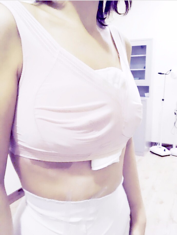 馬戰(zhàn)勝自體脂肪隆胸案例效果對(duì)比圖 馬戰(zhàn)勝自體脂肪隆胸案例效果對(duì)比圖