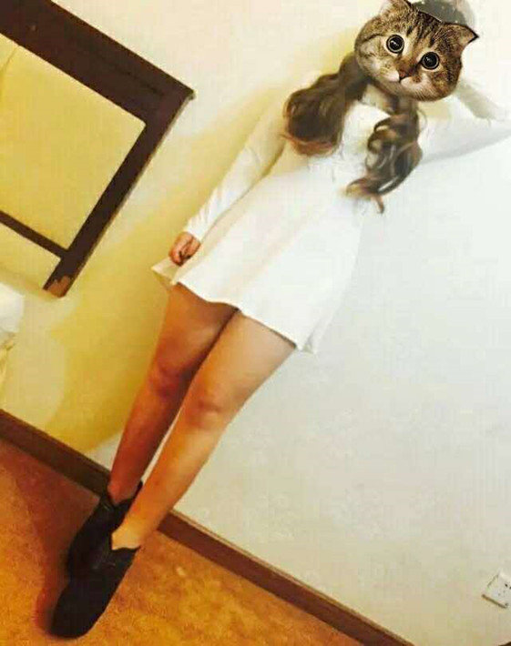 廣州軍頤醫(yī)院整形美容中心石建薇醫(yī)生腰腹吸脂真實案例對比圖 廣州軍頤醫(yī)院整形美容中心石建薇醫(yī)生腰腹吸脂真實案例對比圖