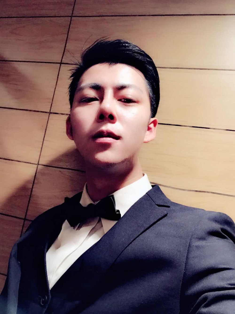 濟(jì)寧名美醫(yī)療整形醫(yī)生李唯少假體隆鼻+耳軟骨墊鼻尖真實(shí)案例效果對比圖