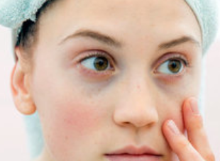 鄭州安格潤(rùn)醫(yī)療美容門診部激光去黑眼圈