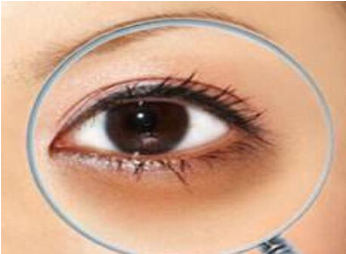 鄭州都市風(fēng)韻醫(yī)療美容門診部激光去黑眼圈