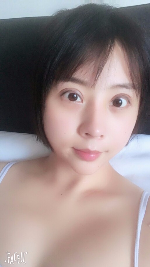 成都晶都醫(yī)療美容醫(yī)院王教授做自體脂肪填充+大腿吸脂+假體隆胸案例分享 成都晶都醫(yī)療美容醫(yī)院王教授做自體脂肪填充+大腿吸脂+假體隆胸案例分享