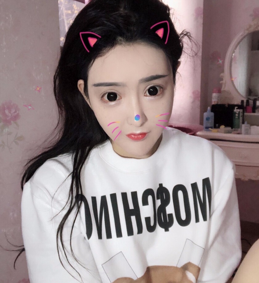 重慶柏漫醫(yī)療美容診所高紅艷醫(yī)生做面部吸脂怎么樣？面部吸脂案例分享