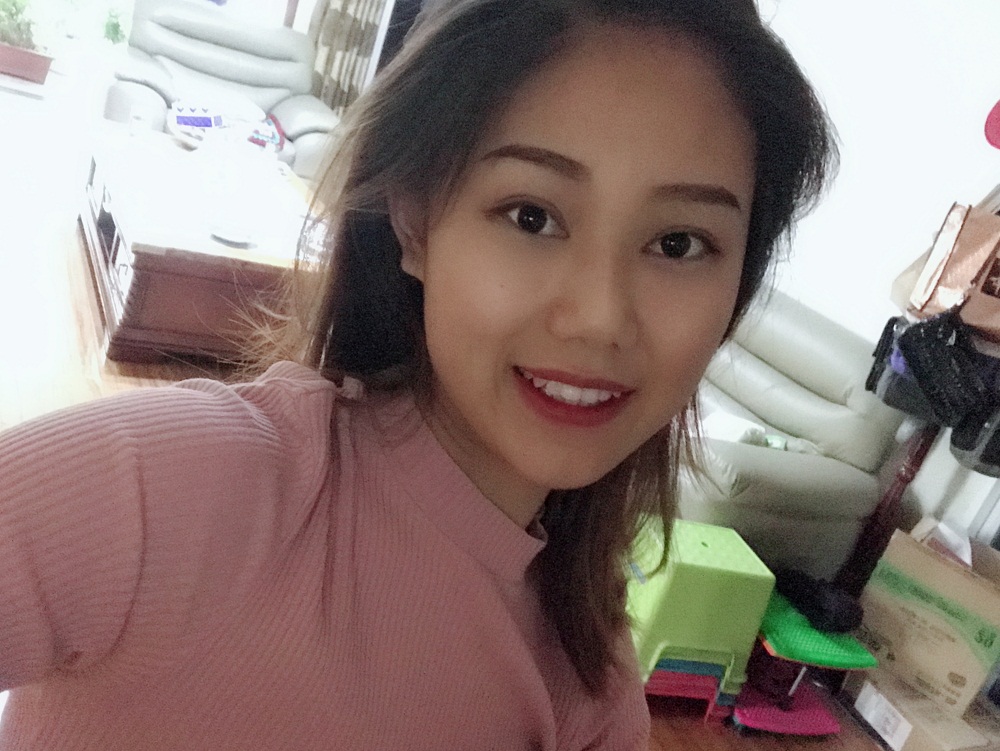 西安藝星埋線提升案例 西安藝星埋線提升案例