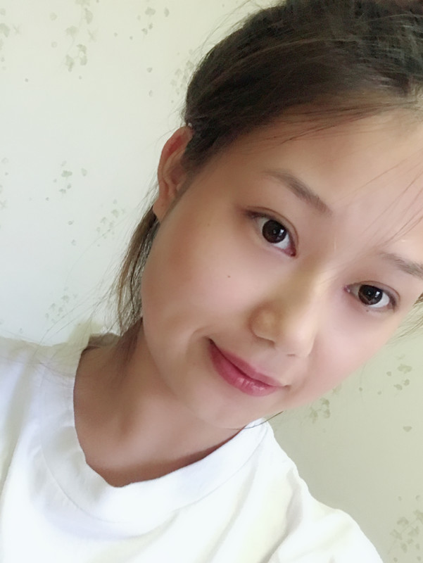 西安藝星整形醫(yī)院徐智慧醫(yī)生做埋線提升怎么樣？附西安藝星埋線提升案例