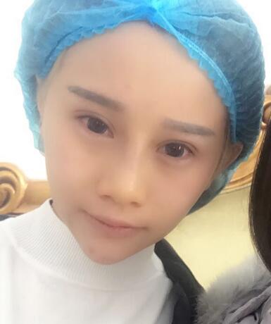 長春奧拉克美容醫(yī)院金相勛醫(yī)生做玻尿酸豐臥蠶怎么樣？附案例