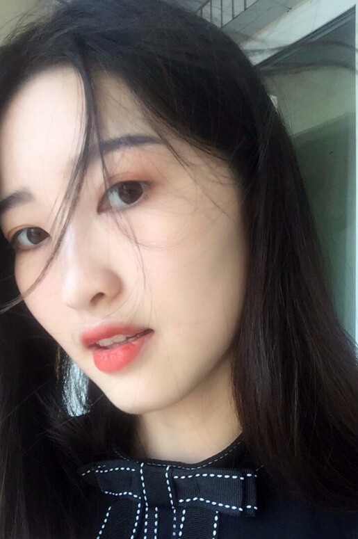 鄭州正合口腔門診部做牙齒矯正怎么樣？附郭毅醫(yī)生牙齒金屬托槽矯正案例