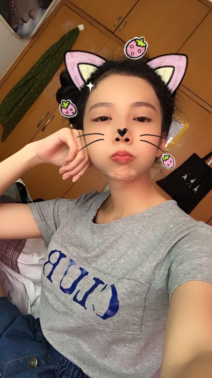 西安高一生醫(yī)療美容醫(yī)院網(wǎng)購恒醫(yī)生做自體脂肪全臉填充案例效果對比圖