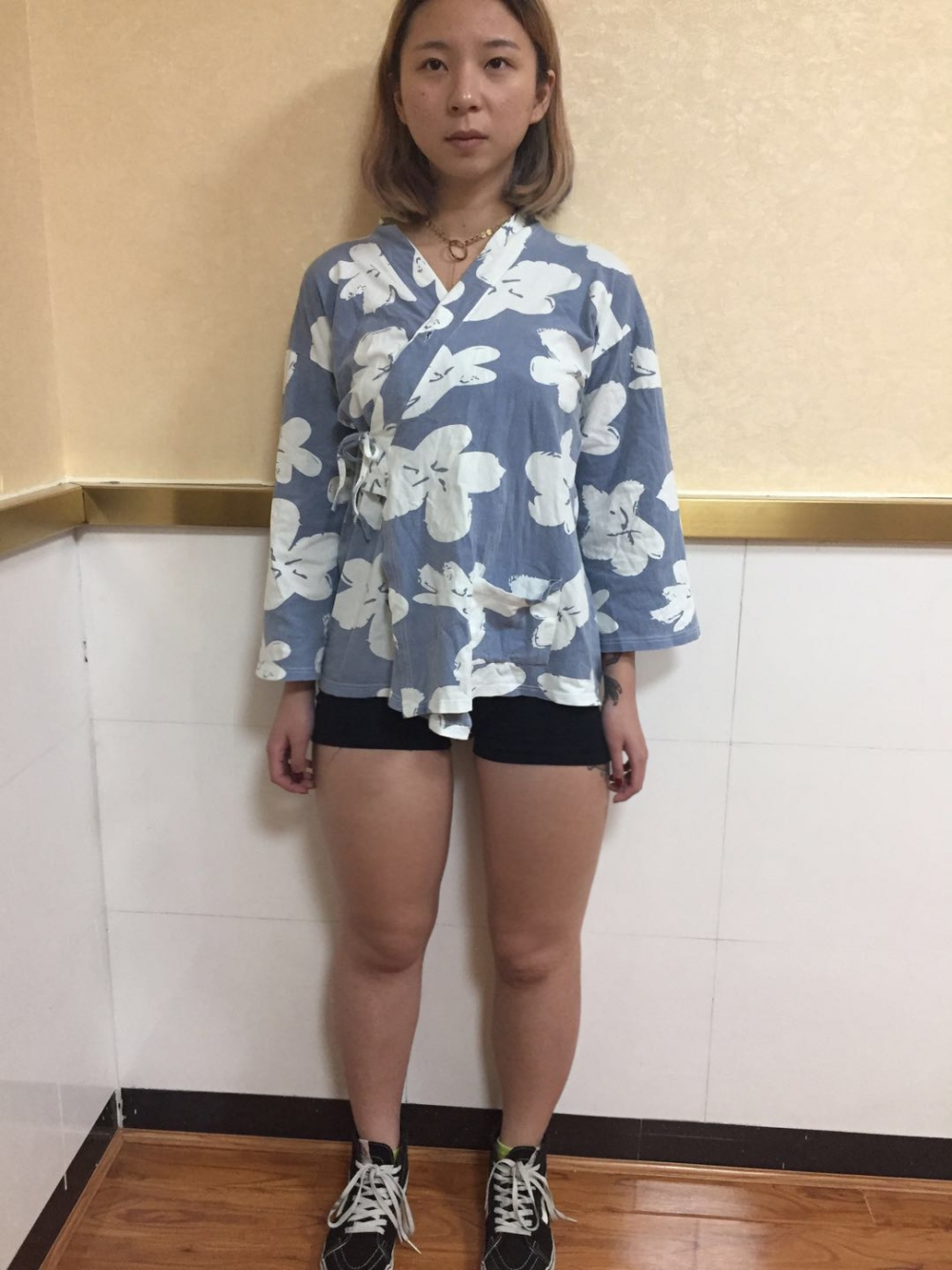 深圳鵬愛醫(yī)療整形醫(yī)生張建文做大腿吸脂怎么樣？附大腿吸脂案例效果對比圖