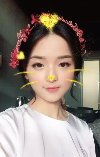 鄭州名門整形醫(yī)院董斌醫(yī)生做下頜角整形怎么樣？附下頜角整形案例