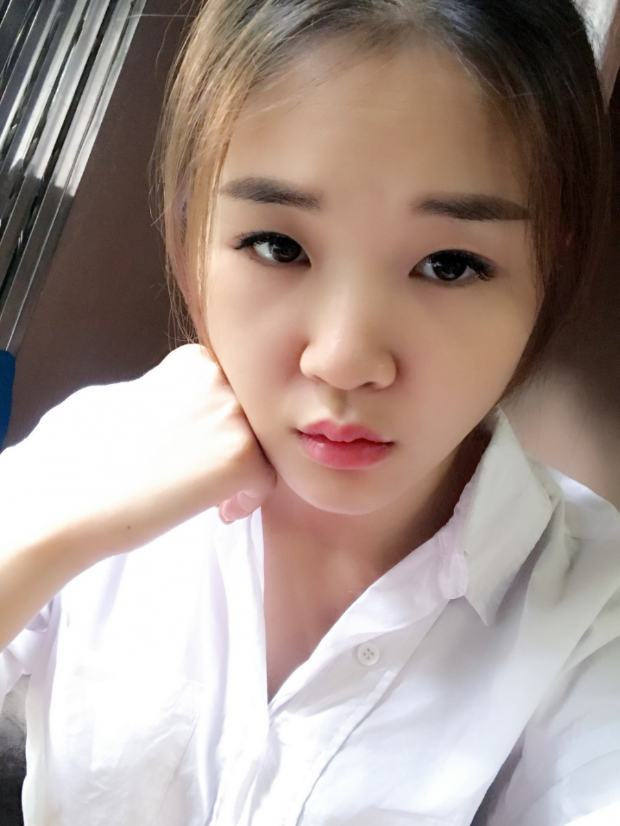 鄭州華領醫(yī)療美容醫(yī)院賀小虎醫(yī)生做眼綜合+鼻部整形手術效果怎么樣？