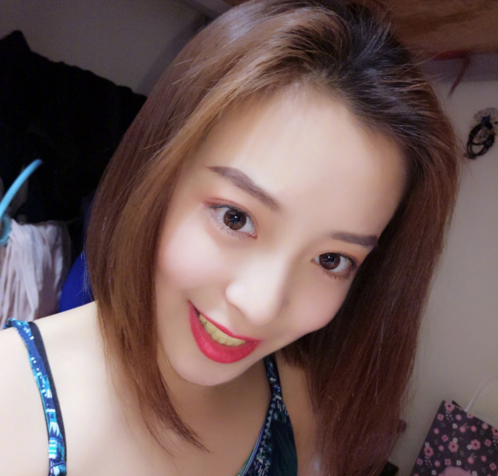 重慶樂樂欣口腔趙麗麗醫(yī)生做冷光美白效果怎么樣？附冷光美白效果對比圖