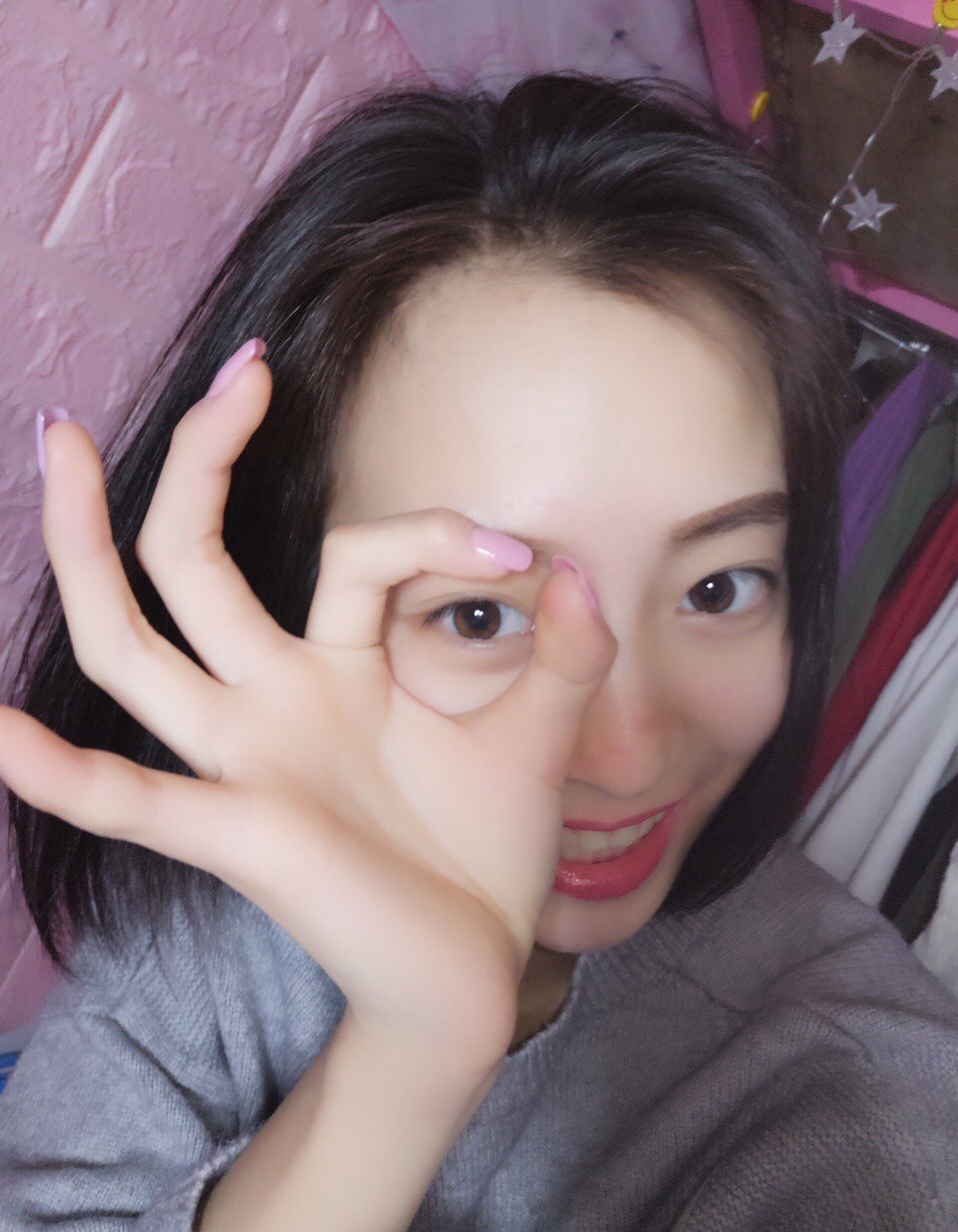 重慶樂樂欣口腔趙麗麗醫(yī)生做冷光美白效果怎么樣？附冷光美白效果對比圖