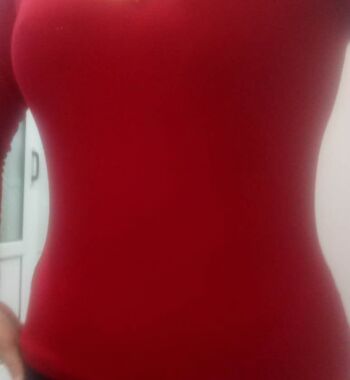 武漢東方麗人醫(yī)院整形美容科胡江偉醫(yī)生做腰腹吸脂案例效果對比圖 武漢東方麗人醫(yī)院整形美容科胡江偉醫(yī)生做腰腹吸脂案例效果對比圖