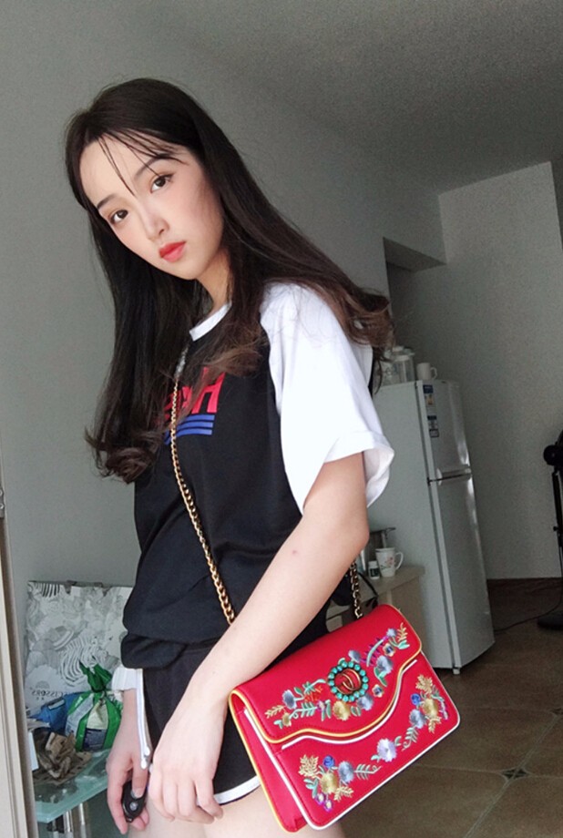 重慶威妮醫(yī)療整形醫(yī)生伊莉做切開雙眼皮+開眼角真人案例效果對比圖