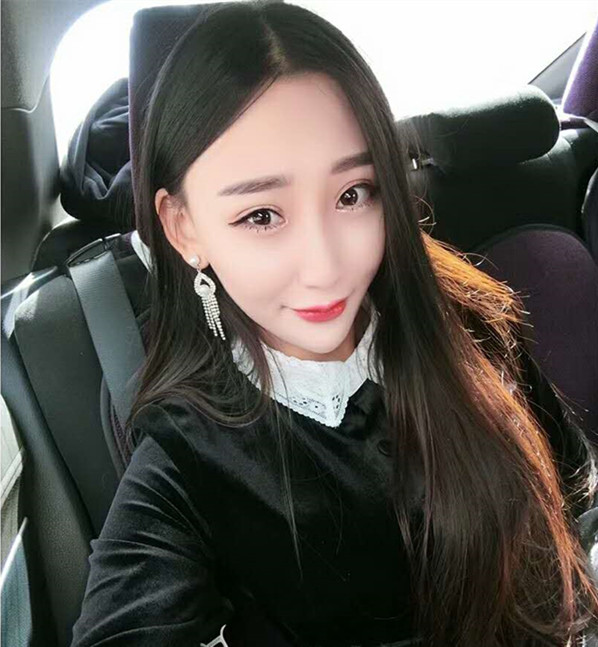 武漢中翰整形外科醫(yī)院沈磊醫(yī)生做切開雙眼皮怎么樣？附沈磊切開雙眼皮案例