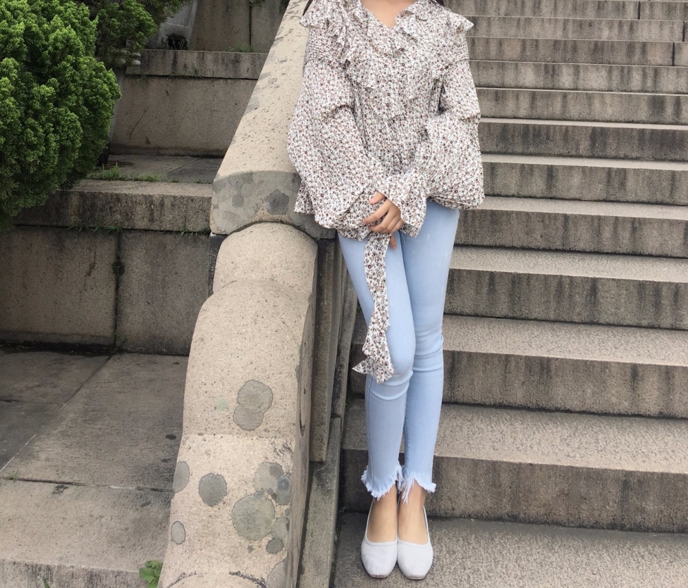 晉城鳳凰整形美容醫(yī)院宋發(fā)興醫(yī)生做大腿吸脂怎么樣？附大腿吸脂案例