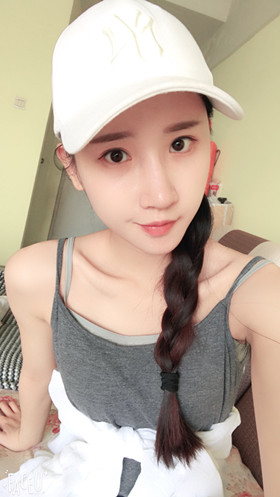 湛江澳泰整形醫(yī)院彭鑫醫(yī)生做自體脂肪豐蘋果肌+太陽(yáng)穴案例效果對(duì)比圖 湛江澳泰整形醫(yī)院彭鑫醫(yī)生做自體脂肪豐蘋果肌+太陽(yáng)穴案例效果對(duì)比圖