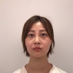 天津歐華威莎整形醫(yī)生姚玲做面部埋線提升效果怎么樣？附埋線提升案例