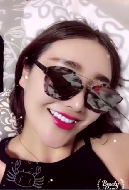 廣州柏德口腔蘭海龍醫(yī)生做瓷貼面效果怎么樣？廣州柏德口腔瓷貼面案例分享