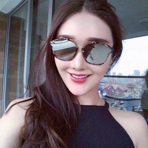 廣州柏德口腔蘭海龍醫(yī)生做瓷貼面效果怎么樣？廣州柏德口腔瓷貼面案例分享