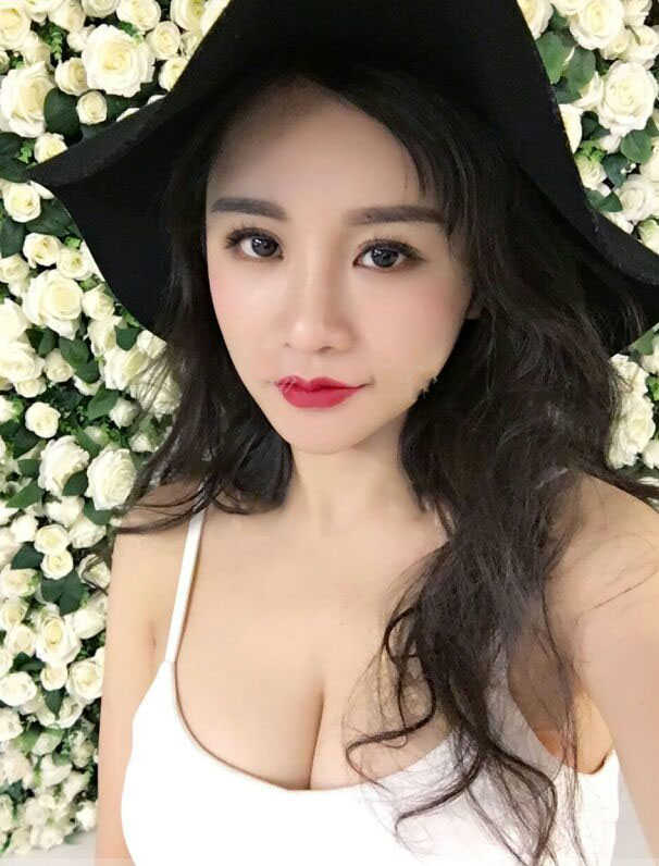 海南韓美醫(yī)學美容醫(yī)院李強醫(yī)生做自體脂肪隆胸效果怎么樣？附案例